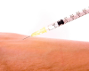 Limited Skin Testing Due to Shortage of Tubersol®