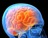 Strike Out Stroke!-Lewisville Library, May 7 4:00 pm